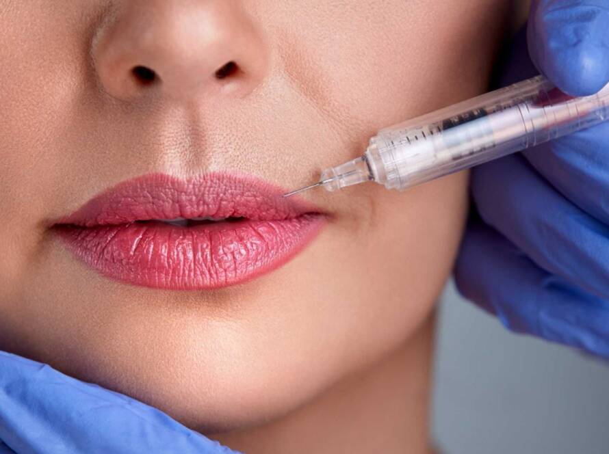 Dermal Fillers