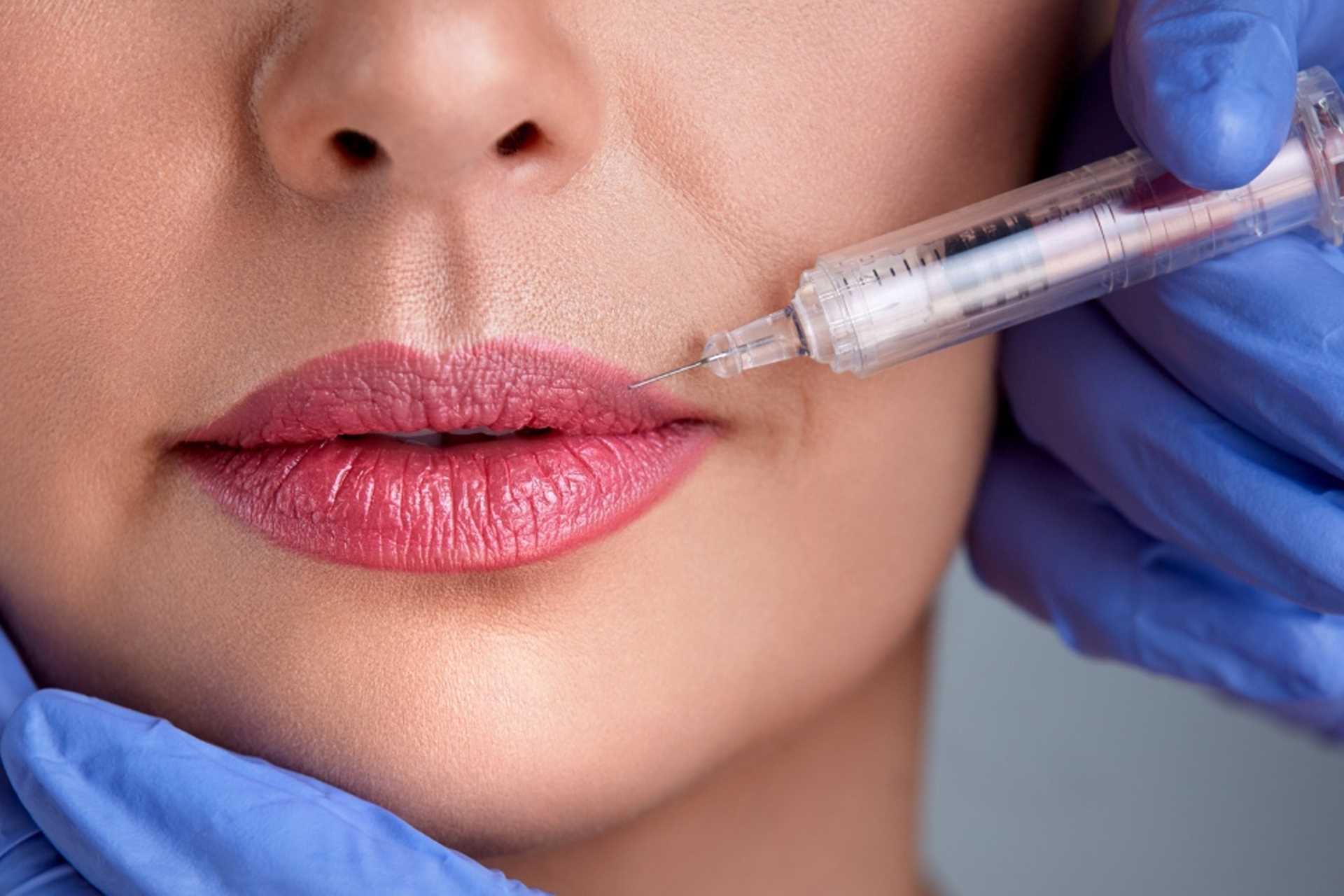 Dermal Fillers