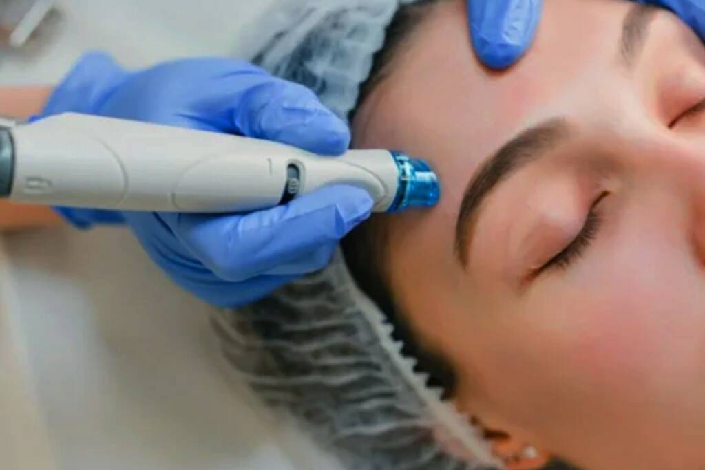 Skin Mesotherapy