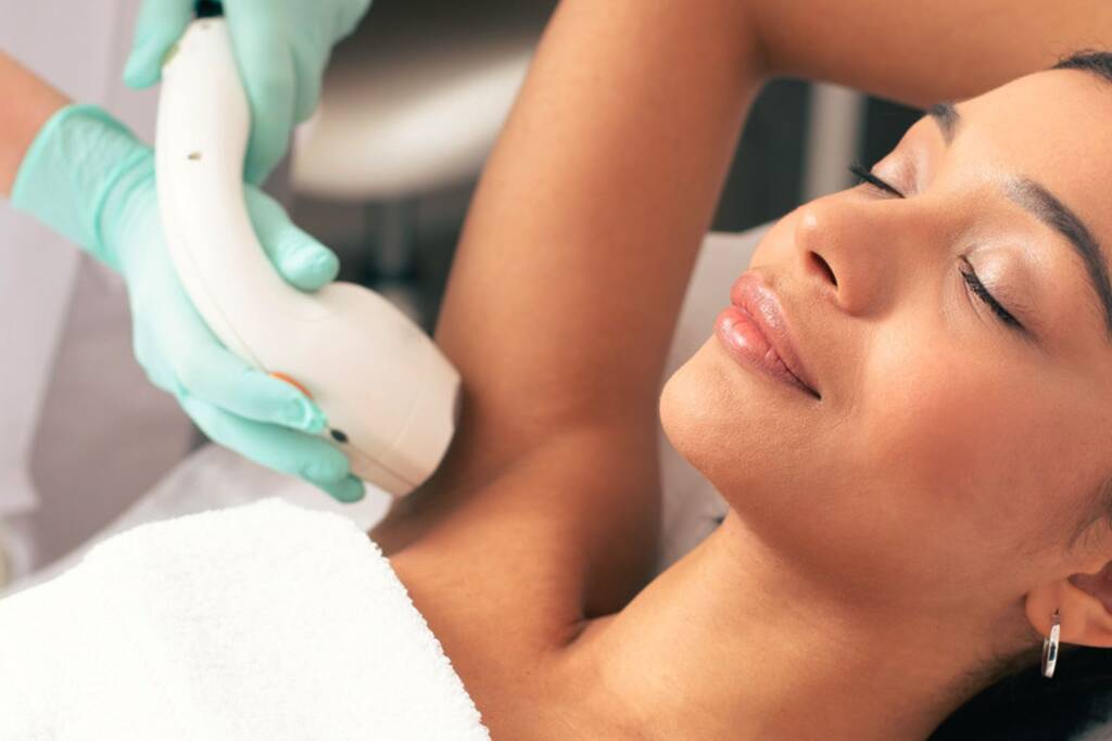 laser hair removal treatment