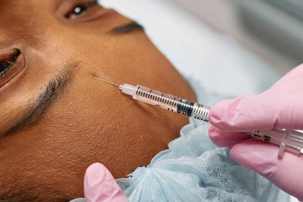 Dermal Fillers