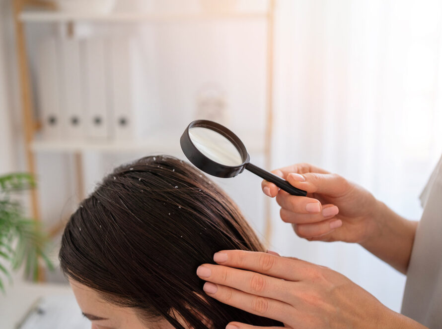 Dandruff Treatment