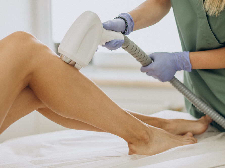 laser hair removal