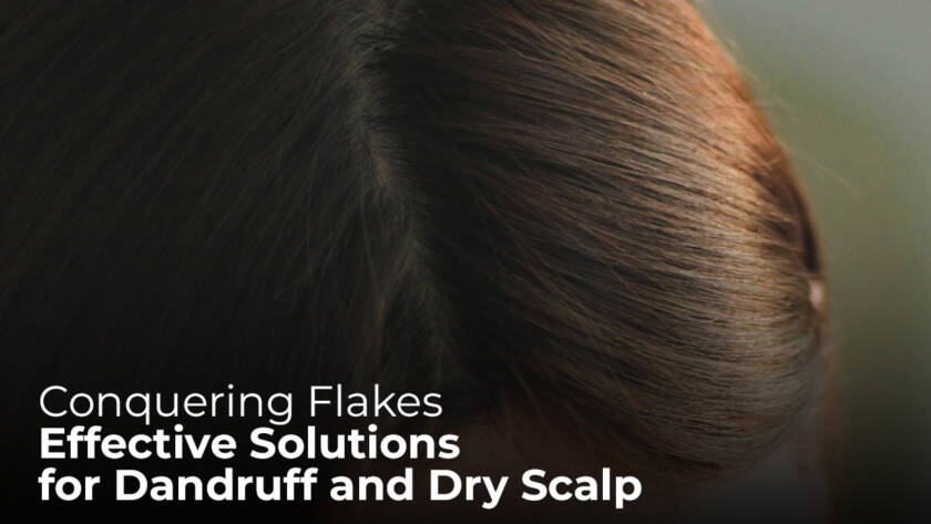 Conquering Flakes: Effective Solutions for Dandruff and Dry Scalp