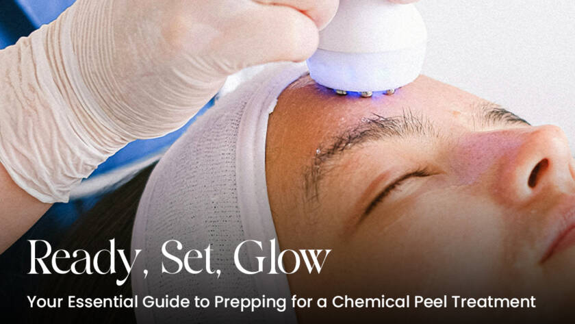 Ready, Set, Glow: Your Essential Guide to Prepping for a Chemical Peel Treatment