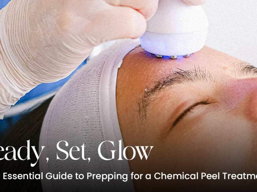 Ready, Set, Glow: Your Essential Guide to Prepping for a Chemical Peel Treatment